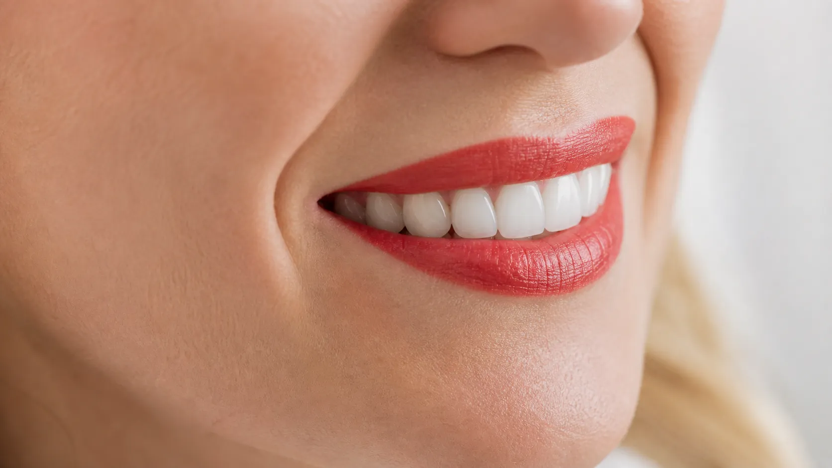 Estética Dental San Rafael